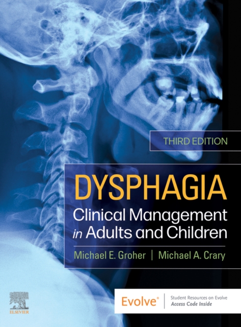 Dysphagia - E-Book : Dysphagia - E-Book, EPUB eBook
