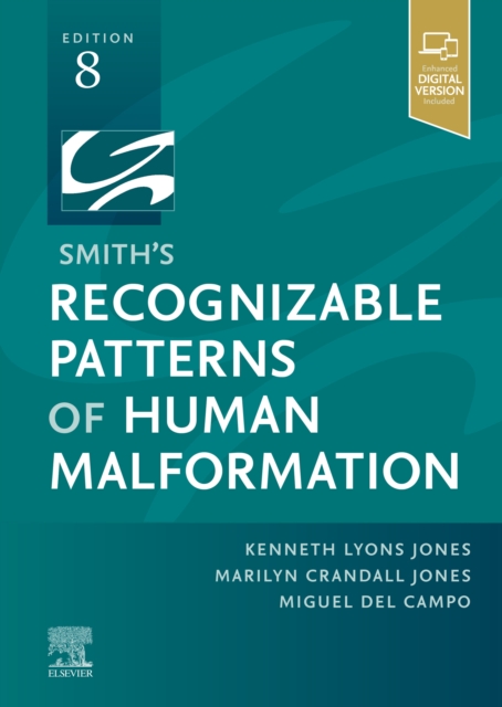 Smith's Recognizable Patterns of Human Malformation - E-Book, EPUB eBook