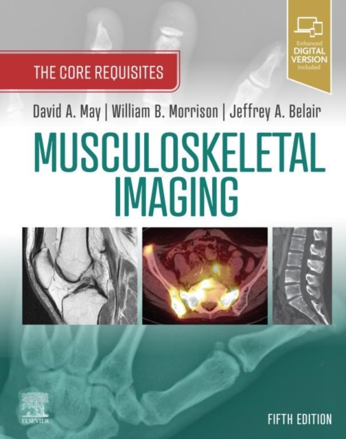 Musculoskeletal Imaging: The Core Requisites E-Book : The Core Requisites, EPUB eBook