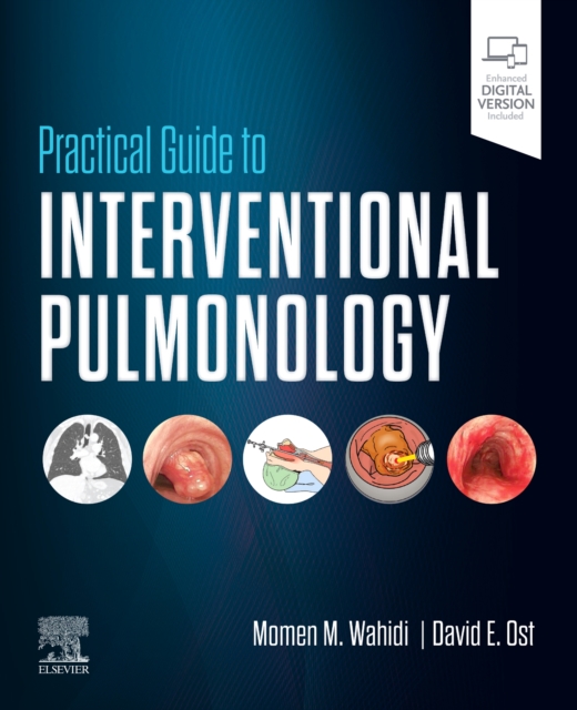 Practical Guide to Interventional Pulmonology, Hardback Book