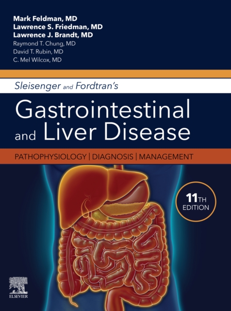 Sleisenger and Fordtran's Gastrointestinal and Liver Disease E-Book : Pathophysiology, Diagnosis, Management, EPUB eBook