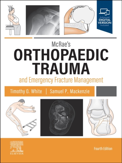 McRae's Orthopaedic Trauma and Emergency Fracture Management E-Book : McRae's Orthopaedic Trauma and Emergency Fracture Management E-Book, EPUB eBook