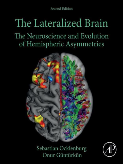 The Lateralized Brain : The Neuroscience and Evolution of Hemispheric Asymmetries, EPUB eBook