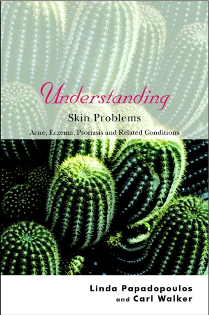 Understanding Skin Problems : Acne, Eczema, Psoriasis and Related Conditions, PDF eBook