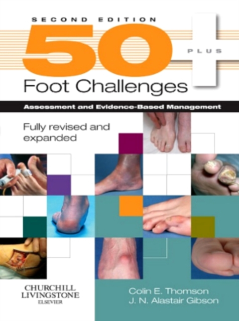 50+ Foot Challenges : Assessment and Evidence-Based Management, EPUB eBook