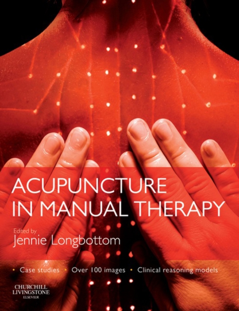 Acupuncture in Manual Therapy, EPUB eBook