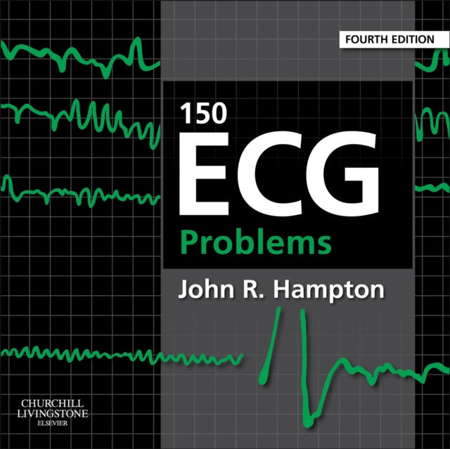 150 ECG Problems E-Book : 150 ECG Problems E-Book, EPUB eBook