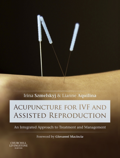 Acupuncture for IVF and Assisted Reproduction : An integrated approach to treatment and management, EPUB eBook