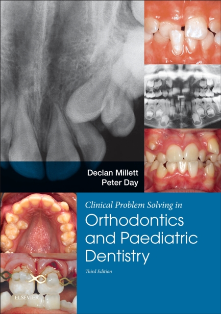 Clinical Problem Solving in Orthodontics and Paediatric Dentistry E-Book : Clinical Problem Solving in Orthodontics and Paediatric Dentistry E-Book, PDF eBook