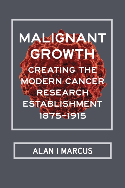 Malignant Growth : Creating the Modern Cancer Research Establishment, 1875-1915, EPUB eBook