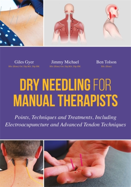 Dry Needling for Manual Therapists : Points, Techniques and Treatments, Including Electroacupuncture and Advanced Tendon Techniques, EPUB eBook