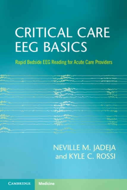 Critical Care EEG Basics : Rapid Bedside EEG Reading for Acute Care Providers, PDF eBook