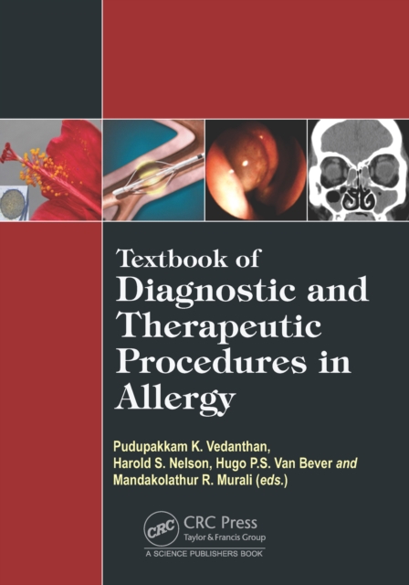 Textbook of Diagnostic and Therapeutic Procedures in Allergy, EPUB eBook