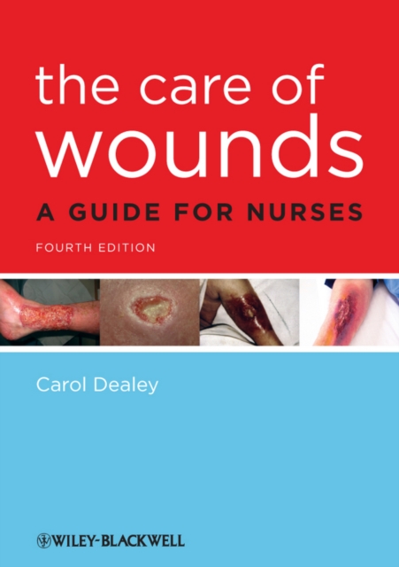 The Care of Wounds : A Guide for Nurses, EPUB eBook