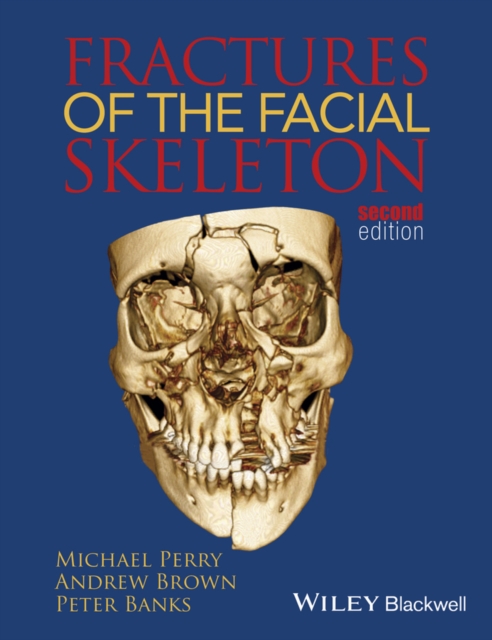 Fractures of the Facial Skeleton, EPUB eBook