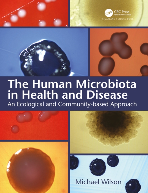 The Human Microbiota in Health and Disease : An Ecological and Community-based Approach, EPUB eBook