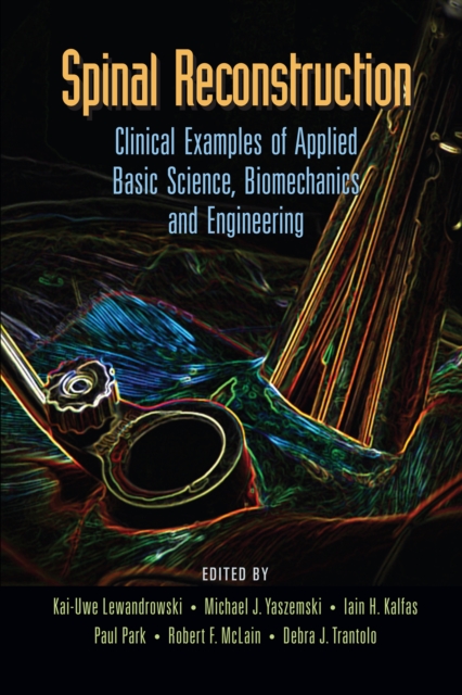 Spinal Reconstruction : Clinical Examples of Applied Basic Science, Biomechanics and Engineering, PDF eBook