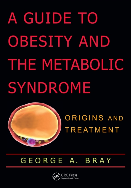 A Guide to Obesity and the Metabolic Syndrome : Origins and Treatment, PDF eBook