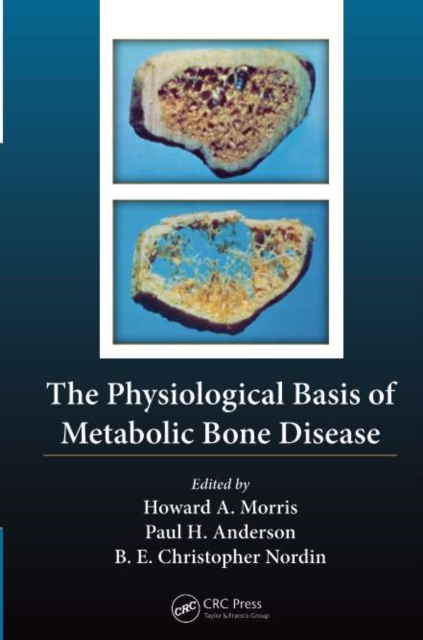 The Physiological Basis of Metabolic Bone Disease, PDF eBook