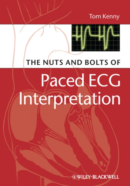 The Nuts and bolts of Paced ECG Interpretation, PDF eBook