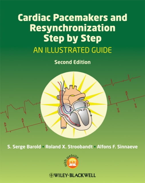 Cardiac Pacemakers and Resynchronization Step by Step : An Illustrated Guide, PDF eBook