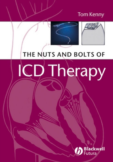 The Nuts and Bolts of ICD Therapy, EPUB eBook