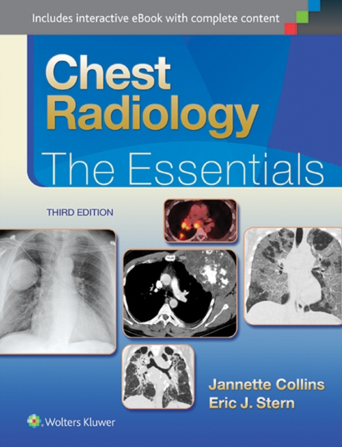 Chest Radiology: The Essentials, Hardback Book