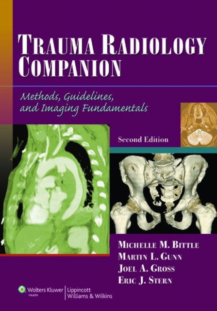 Trauma Radiology Companion : Methods, Guidelines, and Imaging Fundamentals, EPUB eBook