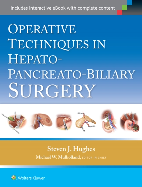 Operative Techniques in Hepato-Pancreato-Biliary Surgery, Hardback Book