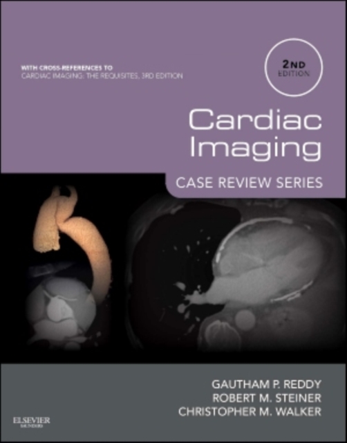 Cardiac Imaging: Case Review Series E-Book, EPUB eBook