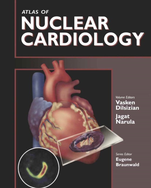 Atlas of Nuclear Cardiology, PDF eBook