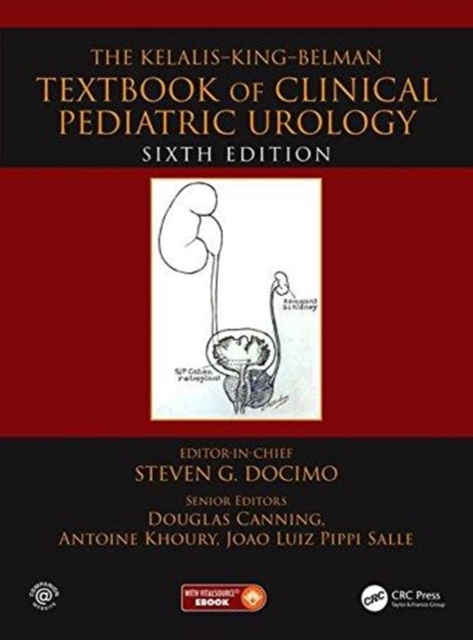 The Kelalis--King--Belman Textbook of Clinical Pediatric Urology, Hardback Book