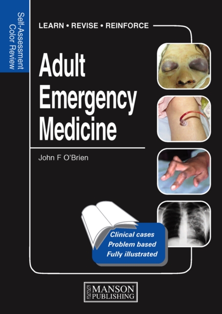 Adult Emergency Medicine : Self-Assessment Color Review, EPUB eBook