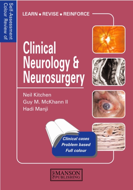 Clinical Neurology and Neurosurgery : Self-Assessment Colour Review, PDF eBook