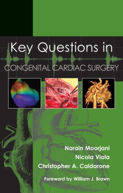 Key Questions in Congenital Cardiac Surgery, EPUB eBook