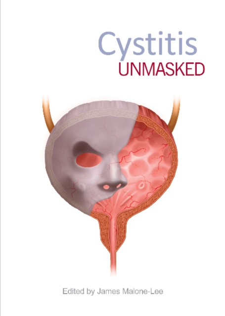 Cystitis Unmasked, Paperback / softback Book