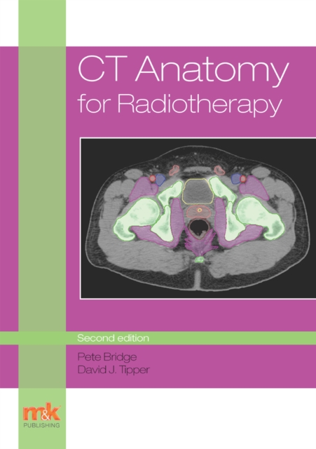 CT Anatomy for Radiotherapy, EPUB eBook