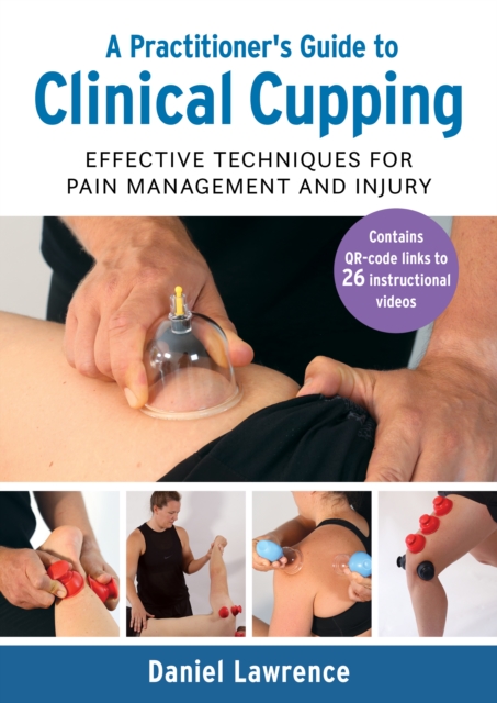 A Practitioner's Guide to Clinical Cupping : Effective Techniques for Pain Management and Injury, Paperback / softback Book