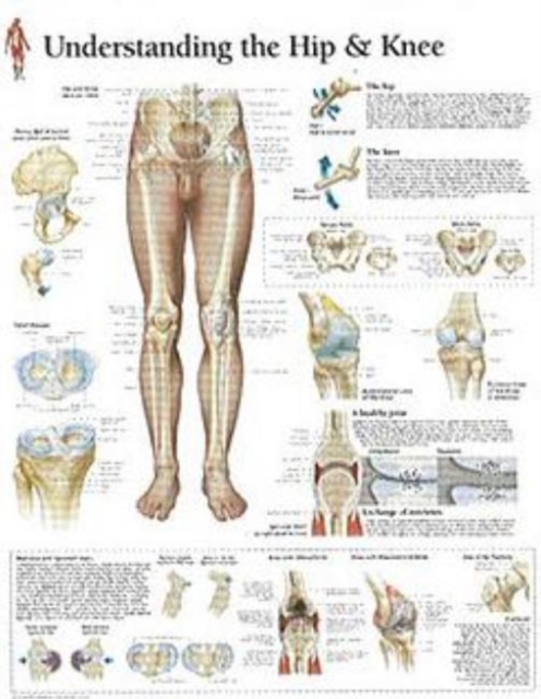 Understanding the Hip & Knee Laminated Poster, Poster Book