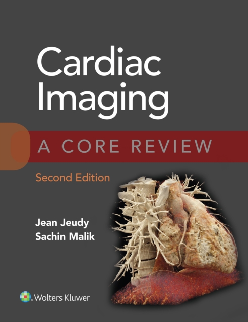 Cardiac Imaging: A Core Review, EPUB eBook