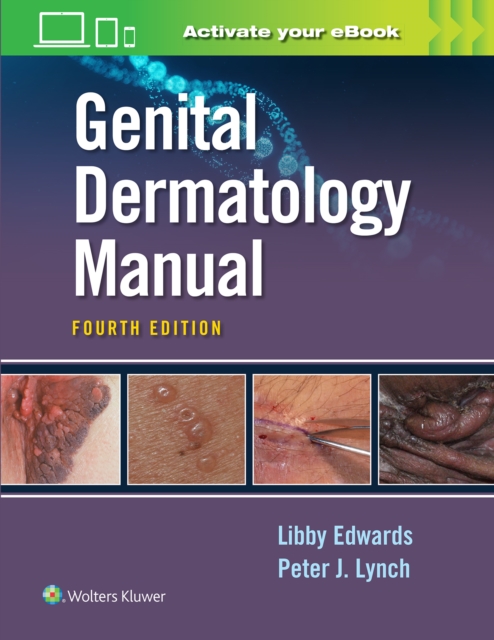 Genital Dermatology  Manual, Paperback / softback Book