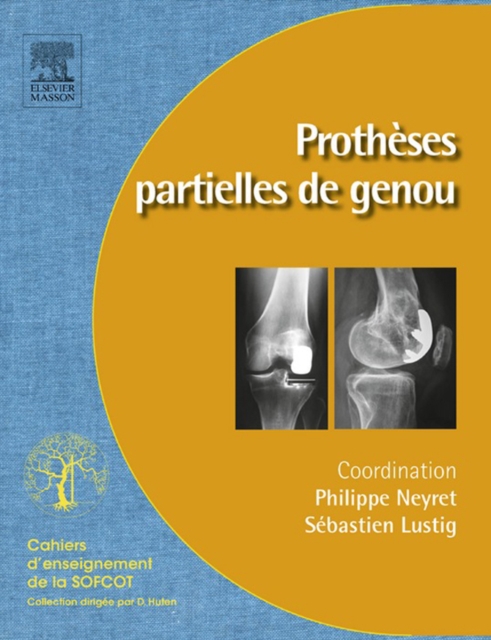 Protheses partielles du genou : Protheses unicompartimentaires et femoropatellaires, EPUB eBook