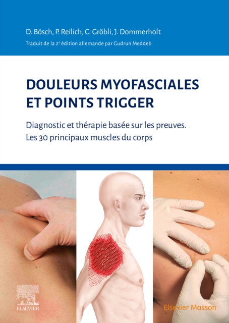 Douleurs myofasciales et points trigger : Diagnostic et therapie basee sur les preuves. Les 30 principaux muscles du corps, EPUB eBook