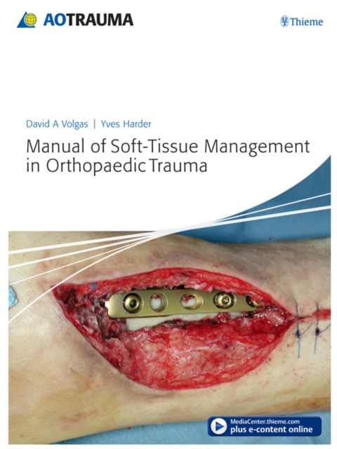Manual of Soft-Tissue Management in Orthopaedic Trauma, EPUB eBook