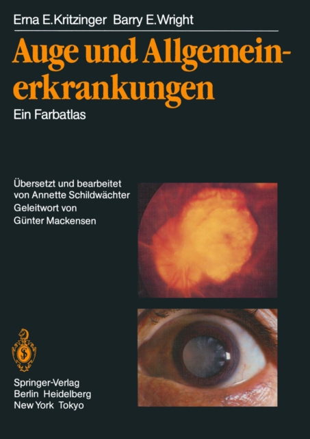 Auge und Allgemeinerkrankungen : Ein Farbatlas, PDF eBook