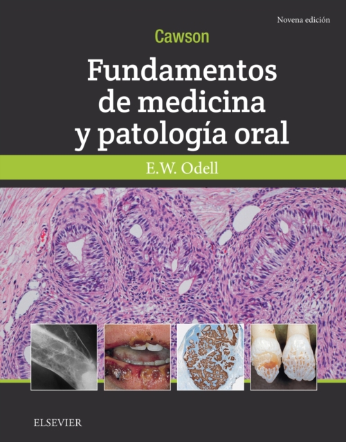 Cawson.Fundamentos de medicina y patologia oral, EPUB eBook