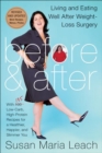 Before & After : Living and Eating Well After Weight-Loss Surgery - eBook