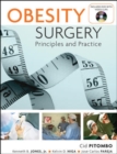 Obesity Surgery: Principles and Practice - eBook