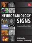 Neuroradiology Signs - eBook