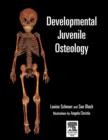 Developmental Juvenile Osteology - eBook